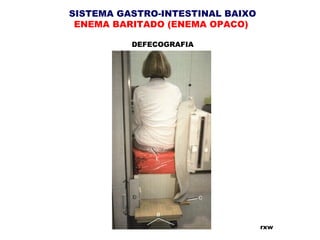 SISTEMA GASTRO-INTESTINAL BAIXO
ENEMA BARITADO (ENEMA OPACO)
DEFECOGRAFIA
rxw
 