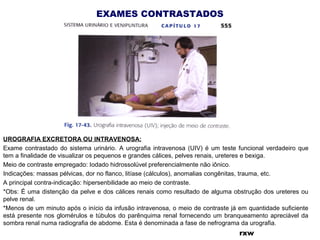 EXAMES CONTRASTADOS
rxw
UROGRAFIA EXCRETORA OU INTRAVENOSA:
Exame contrastado do sistema urinário. A urografia intravenosa (UIV) é um teste funcional verdadeiro que
tem a finalidade de visualizar os pequenos e grandes cálices, pelves renais, ureteres e bexiga.
Meio de contraste empregado: Iodado hidrossolúvel preferencialmente não iônico.
Indicações: massas pélvicas, dor no flanco, litíase (cálculos), anomalias congênitas, trauma, etc.
A principal contra-indicação: hipersenbilidade ao meio de contraste.
*Obs: É uma distenção da pelve e dos cálices renais como resultado de alguma obstrução dos ureteres ou
pelve renal.
*Menos de um minuto após o início da infusão intravenosa, o meio de contraste já em quantidade suficiente
está presente nos glomérulos e túbulos do parênquima renal fornecendo um branqueamento apreciável da
sombra renal numa radiografia de abdome. Esta é denominada a fase de nefrograma da urografia.
 