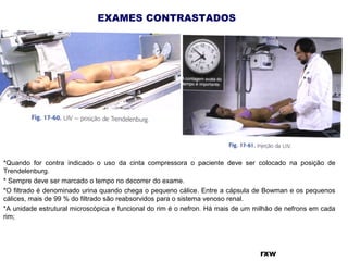 EXAMES CONTRASTADOS
rxw
*Quando for contra indicado o uso da cinta compressora o paciente deve ser colocado na posição de
Trendelenburg.
* Sempre deve ser marcado o tempo no decorrer do exame.
*O filtrado é denominado urina quando chega o pequeno cálice. Entre a cápsula de Bowman e os pequenos
cálices, mais de 99 % do filtrado são reabsorvidos para o sistema venoso renal.
*A unidade estrutural microscópica e funcional do rim é o nefron. Há mais de um milhão de nefrons em cada
rim;
 