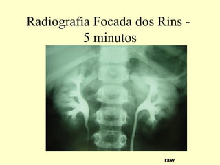 Radiografia Focada dos Rins -
5 minutos
rxw
 