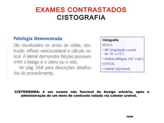 EXAMES CONTRASTADOS
CISTOGRAFIA
rxw
CISTOGRAMA: é um exame não funcinal da bexiga urinária, após a
administração de um meio de contraste iodado via cateter uretral.
 