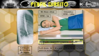 PERFIL DIREITO
Colimação:
de 12 a 15cm
de largura
Perfil direito - RC ┴ RI a nível de T5 ou T6 (de 5 a 7,5cm
abaixo da incisura jugular)
DFRI – 1m
RI: 35cm x 43cm Ortostática -
DFRI – 1,80m
Respiração – suspender e expor na expiração.
 