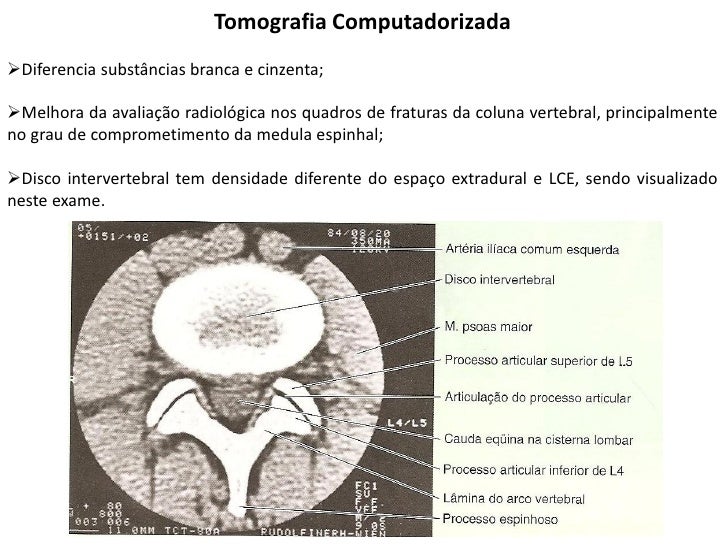 Exame da coluna cervical