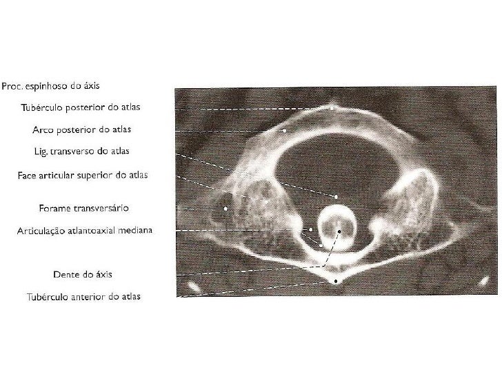 Exame da coluna cervical