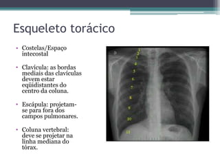 Esqueleto torácico
• Costelas/Espaço
intecostal
• Clavícula: as bordas
mediais das clavículas
devem estar
eqüidistantes do
centro da coluna.
• Escápula: projetam-
se para fora dos
campos pulmonares.
• Coluna vertebral:
deve se projetar na
linha mediana do
tórax.
 