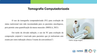 Tomografia Computadorizada
O uso da tomografia computadorizada (TC) para avaliação do
status nutricional tem sido recomendada para os pacientes oncológicos,
pois permite uma quantificação da massa muscular. (MIOLA, 2021)
Em razão da elevada radiação, o uso da TC para avaliação da
composição corporal é reservado para pacientes que já realizariam este
exame por outra indicação clínica (“exame de conveniência”) FONTE: Google Imagens
 