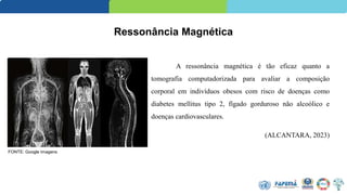 Ressonância Magnética
A ressonância magnética é tão eficaz quanto a
tomografia computadorizada para avaliar a composição
corporal em indivíduos obesos com risco de doenças como
diabetes mellitus tipo 2, fígado gorduroso não alcoólico e
doenças cardiovasculares.
(ALCANTARA, 2023)
FONTE: Google Imagens
 