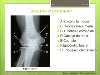 Avaliação de Exames de Imagem - Enfermagem | PPTX