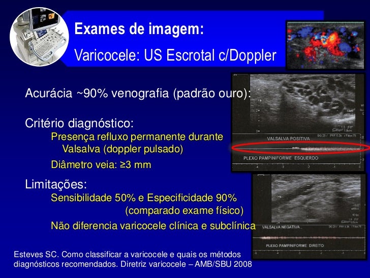 Exame de na