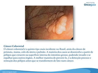 Rastreamento do HIV
Indivíduos infectados pelo vírus HIV podem permanecer sem sintomas por
muitos anos. A única maneira de saber que estão infectados é realizando uma
série de exames de sangue. ELISA ou EIA procuram por anticorpos anti-HIV no
sangue. No entanto é possível não estar infectado e ter um resultado positivo.
Assim, um segundo exame, denominado Western Blot deve ser realizado para
confirmação. Se você foi recentemente infectada, é possível ter um resultado
negativo. A repetição do exame é sempre recomendada. Se você acha que pode
ter sido exposta ao HIV, converse com seu médico sobre a realização de exames.
 