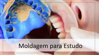 Moldagem para Estudo
 