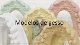 Modelos de gesso
 