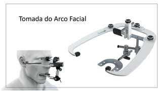 Tomada do Arco Facial
 