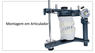 Montagem em Articulador
 