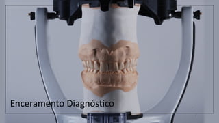 Enceramento Diagnós$co
 
