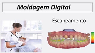 Moldagem Digital
Escaneamento
 