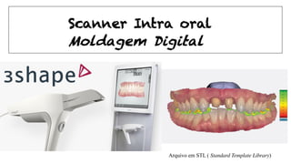 Moldagem Digital
Arquivo em STL ( Standard Template Library)
Scanner Intra oral
 
