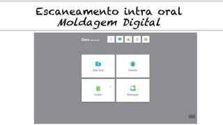 Moldagem Digital
Escaneamento intra oral
 