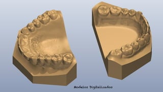 Modelos Digitalizados
 