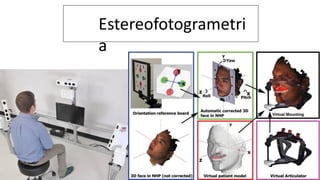 ria Estereofotogrametri
a
 