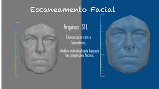 Escaneamento Facial
Arquivos .STL
Comunicação com o
laboratório;
Análise individualizada baseada
nas proporções faciais;
 