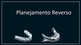 Planejamento Reverso
 