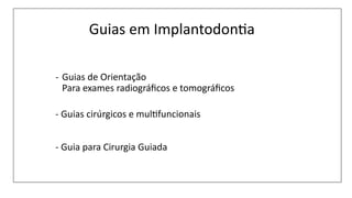 Guias em Implantodon$a
- Guias de Orientação
Para exames radiográﬁcos e tomográﬁcos
- Guias cirúrgicos e mulBfuncionais
- Guia para Cirurgia Guiada
 