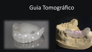 Guia Tomográﬁco
 