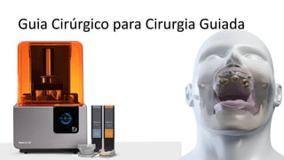 Guia Cirúrgico para Cirurgia Guiada
 