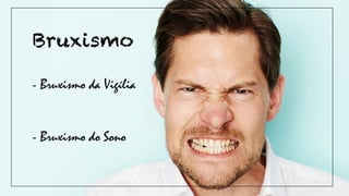 - Bruxismo da Vigília
- Bruxismo do Sono
Bruxismo
 