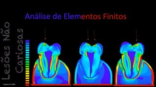 Análise de Elementos Finitos
Grippo et al 2005
 
