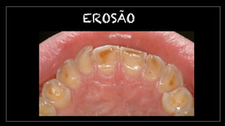EROSAO
~
 