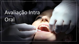 Avaliação Intra
Oral
 