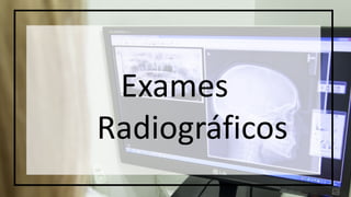 Exames
Radiográficos
 