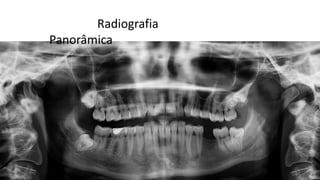 Radiografia
Panorâmica
 