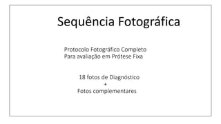 Sequência Fotográfica
Protocolo Fotográfico Completo
Para avaliação em Prótese Fixa
18 fotos de Diagnóstico
+
Fotos complementares
 
