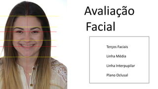 Avaliação
Facial
Terços Faciais
Linha Média
Linha Interpupilar
Plano Oclusal
 