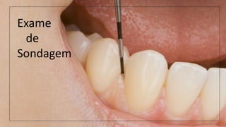 Exame
de
Sondagem
 
