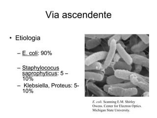 Via ascendente

• Etiologia

  – E. coli: 90%

  – Staphylococus
    saprophyticus: 5 –
    10%
  – Klebsiella, Proteus: 5-
    10%
                              E. coli. Scanning E.M. Shirley
                              Owens. Center for Electron Optics.
                              Michigan State University.
 