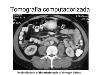 Tomografia computadorizada
 