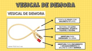 MATERIAL EM LÁTEX
SILICONIZADO, ATÓXICO,
FLEXÍVEL E ESTÉRIL
PONTA DE FOLEY COM
BALONETE INFLÁVEL
ABERTURA PARA
DRENAGEM DA URINA.
ABERTURA PARA ENCHIMENTO
E ESVAZIAVEMENTO DO
BALONETE COM A SERINGA.
cateter FOLEY de 2 vias
vESICAL DE DEMORA
vESICAL DE DEMORA
VESICAL DE DEMORA
VESICAL DE DEMORA
VESICAL DE DEMORA
 