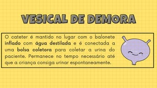 O cateter é mantido no lugar com o balonete
inflado com água destilada e é conectada a
uma bolsa coletora para coletar a urina do
paciente. Permanece no tempo necessário até
que a criança consiga urinar espontaneamente.
vESICAL DE DEMORA
vESICAL DE DEMORA
 