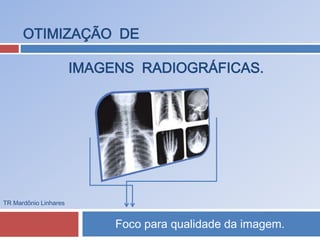 OTIMIZAÇÃO DE 
IMAGENS RADIOGRÁFICAS. 
Foco para qualidade da imagem. 
TR Mardônio Linhares 
 