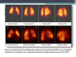 Exames radiológicos II | PPTX