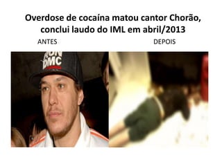 Overdose de cocaína matou cantor Chorão,
conclui laudo do IML em abril/2013
antes
ANTES DEPOIS
 