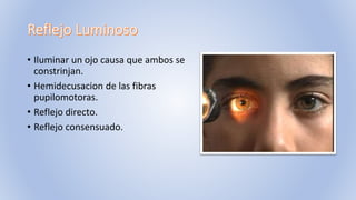 • Iluminar un ojo causa que ambos se
constrinjan.
• Hemidecusacion de las fibras
pupilomotoras.
• Reflejo directo.
• Reflejo consensuado.
 