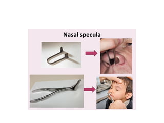 examination-of-nose (1).pptx is helpful for ENT | PPTX