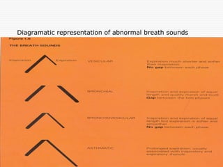 Diagramatic representation of abnormal breath sounds
 