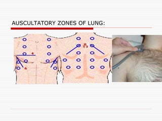 AUSCULTATORY ZONES OF LUNG:
 