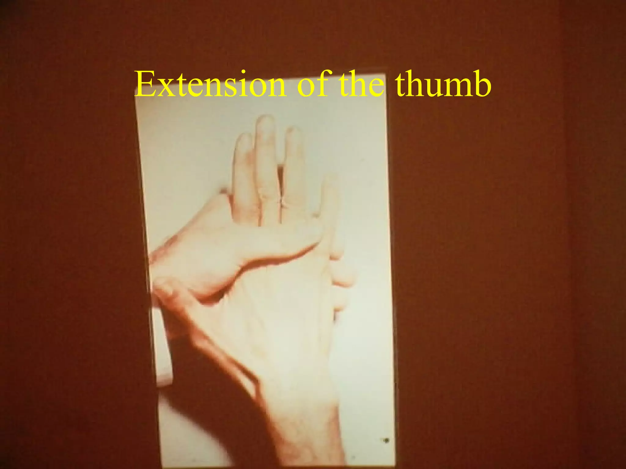 Examination Of The Hand & Wrist | PPT